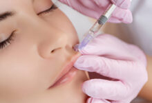 تفاوت ژل لب روسی با مدل لب طبیعی؛ نظر بهترین دکتر تزریق ژل لب در شیراز