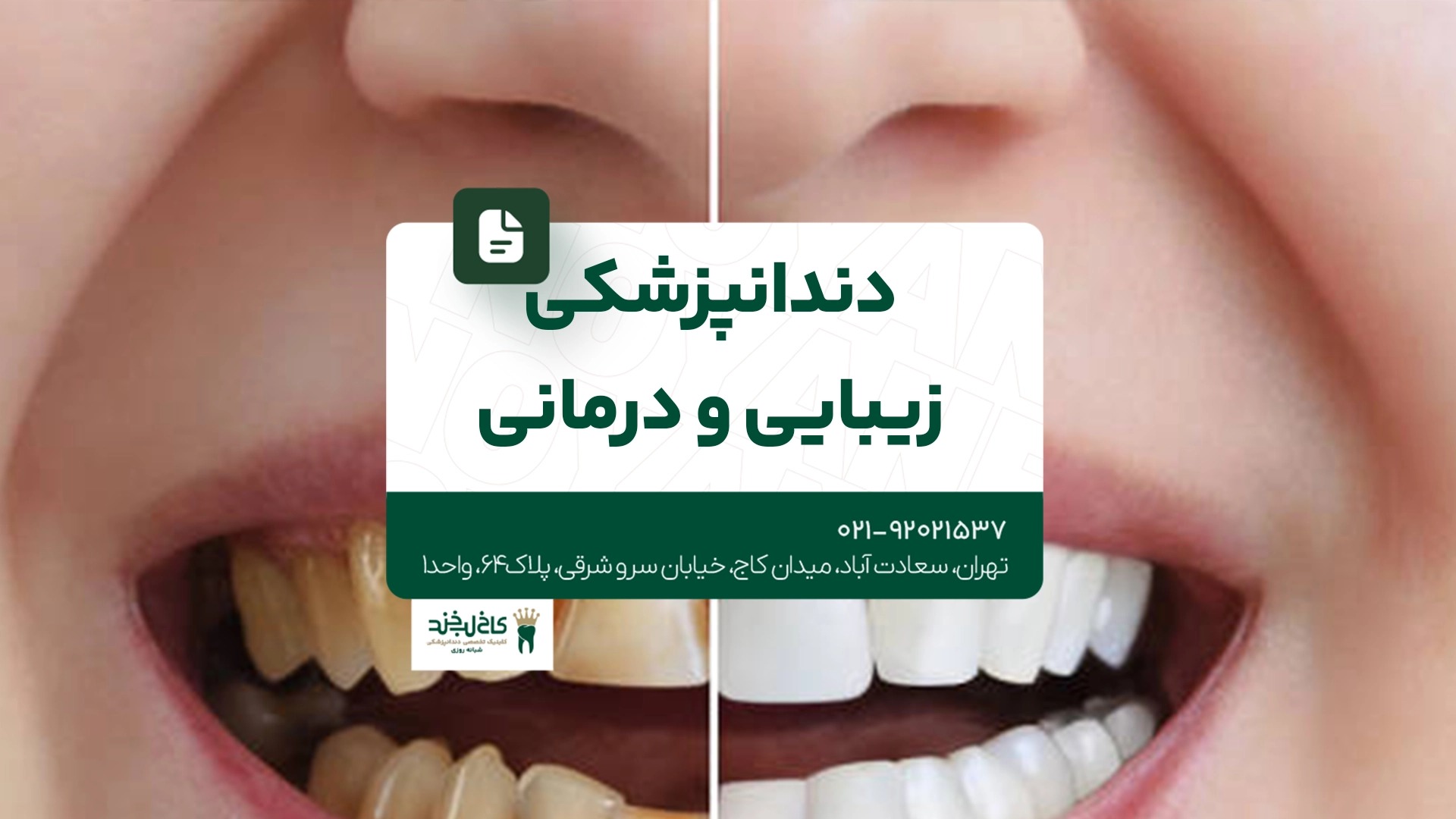 دندانپزشکی زیبایی و درمانی